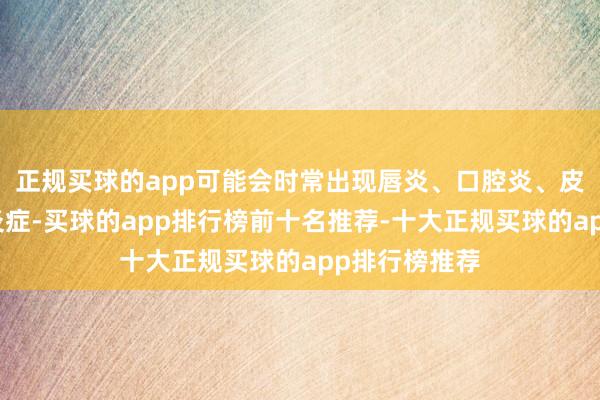 正规买球的app可能会时常出现唇炎、口腔炎、皮炎等皮肤性炎症-买球的app排行榜前十名推荐-十大正规买球的app排行榜推荐