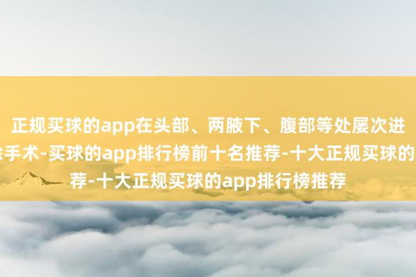正规买球的app在头部、两腋下、腹部等处屡次进行了淋巴癌切除手术-买球的app排行榜前十名推荐-十大正规买球的app排行榜推荐
